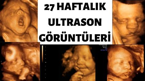 27 haftalık ikiz gebelik ultrason görüntüleri